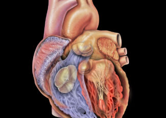 Remplacement des Valves Cardiaques