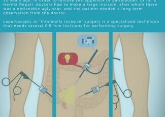 Coelioscopie Diagnostique