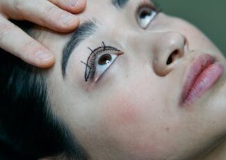 Blépharoplastie