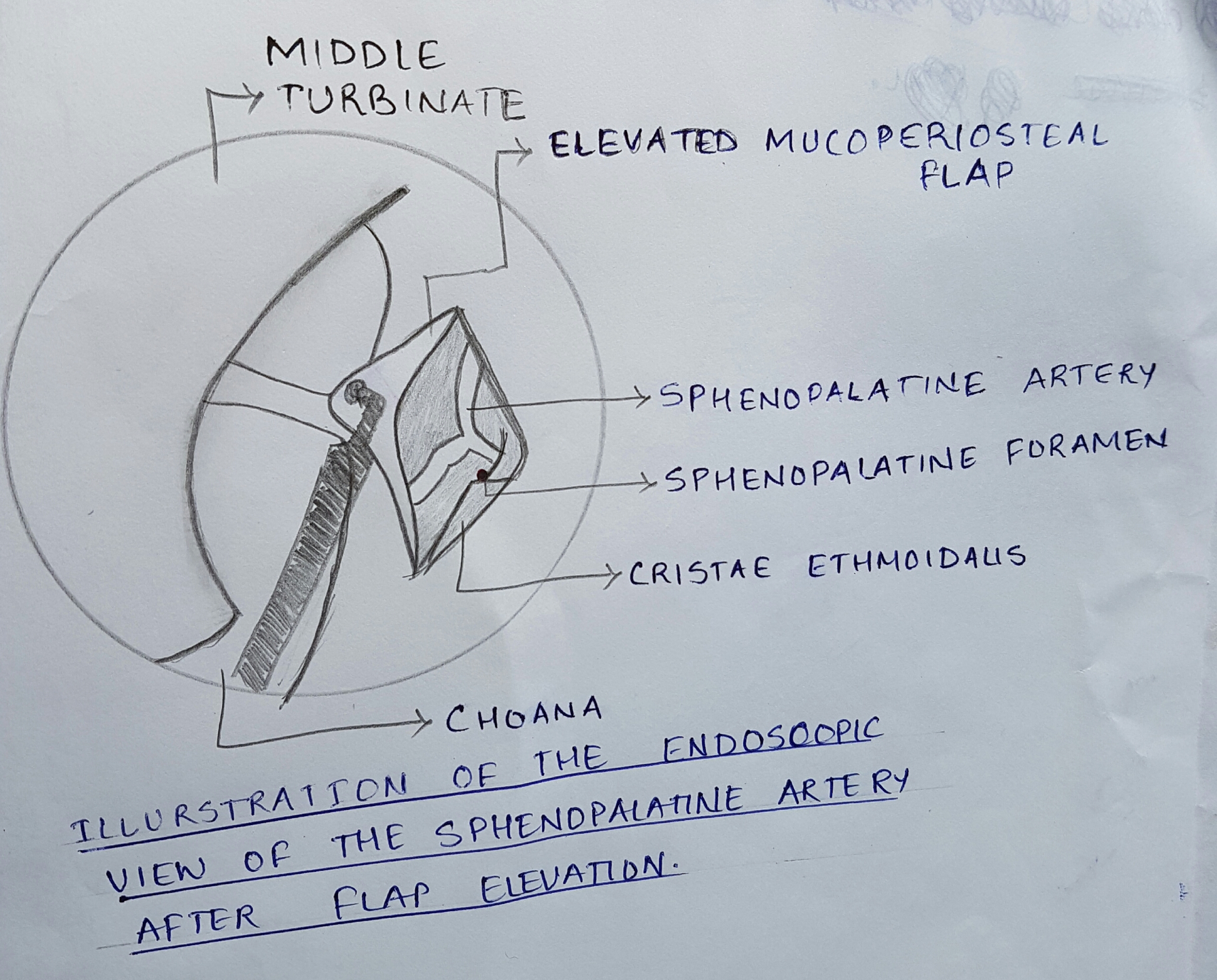 Dissection Sous-Muqueuse Endoscopique,