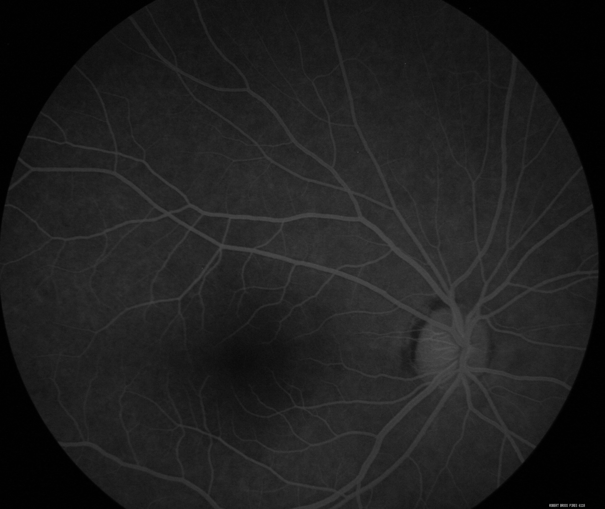 Réussissez vos examens d'Angiographie Fluorescéine : Des recommandations exclusives pour maximiser l'efficacité et la précision de votre diagnostic