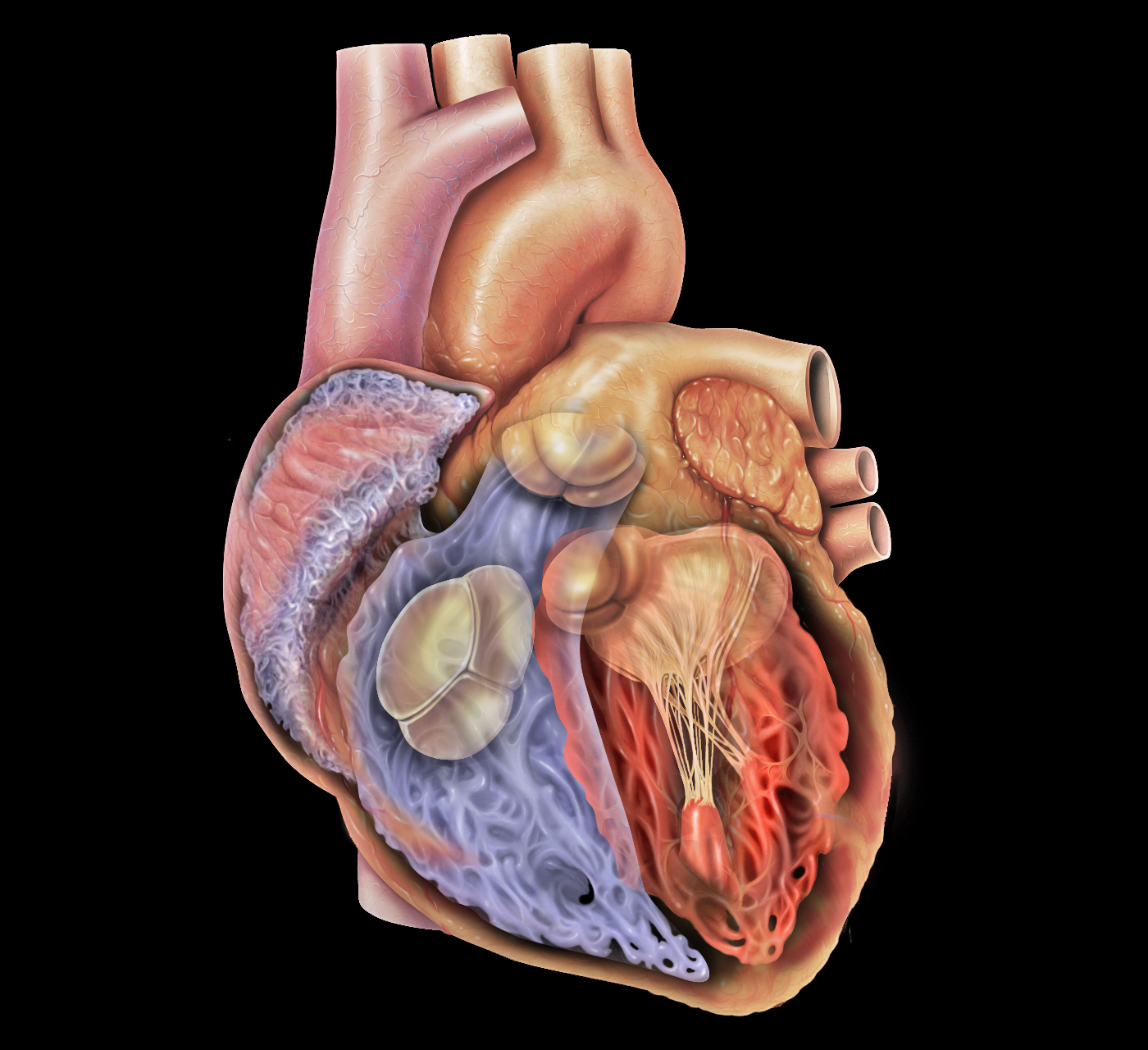 Remplacement des Valves ⁣Cardiaques,