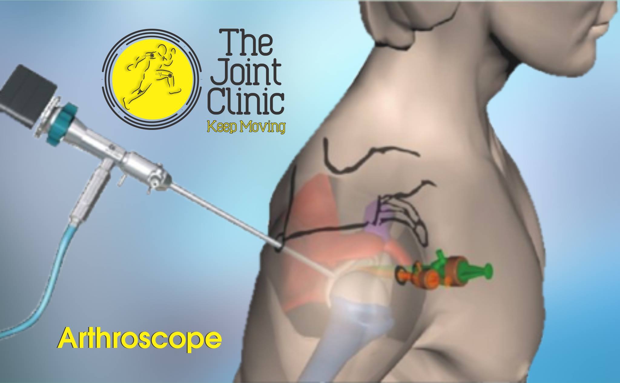 - ⁣Recommandations pour une récupération ​réussie après une ⁣arthroscopie de ‍la⁣ colonne vertébrale