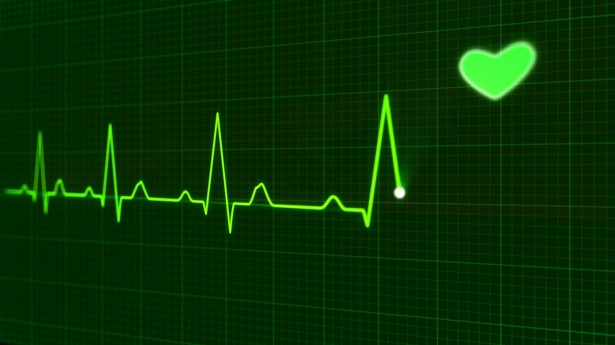 Electrocardiogramme,