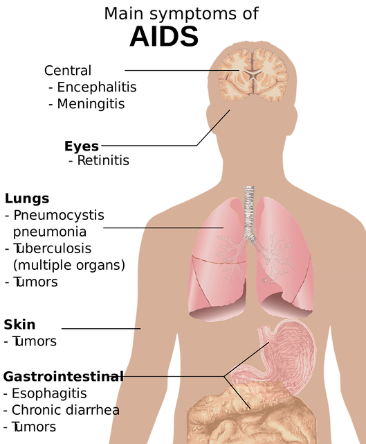 1. L'espoir d'une rémission : Comprendre l'ablation d'une Tumeur‍ de la Moelle Osseuse pour offrir une ⁤vie sans limites