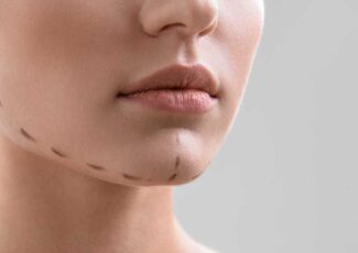Augmentation Du Menton