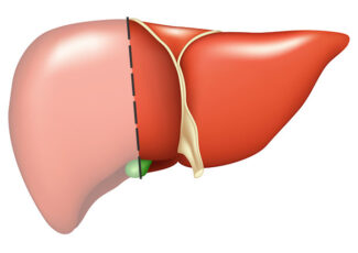 Hépatectomie