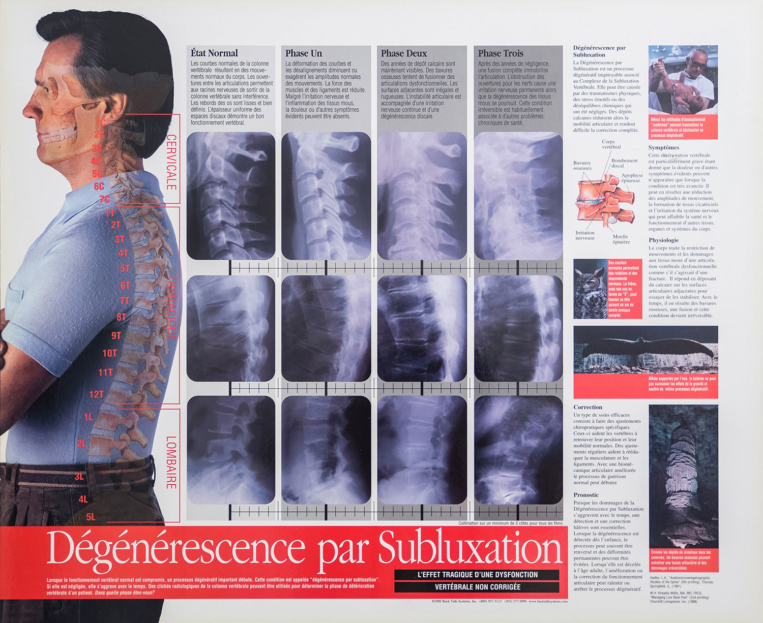 Les bienfaits de la Sympathectomie Cervico-Thoracique : Une ​lueur d'espoir pour⁣ soulager les ​troubles ⁤graves